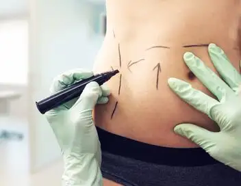 Ça se discute - Saison 1 - Chirurgie esthétique : du premier coup de bistouri à l'addiction – affiche